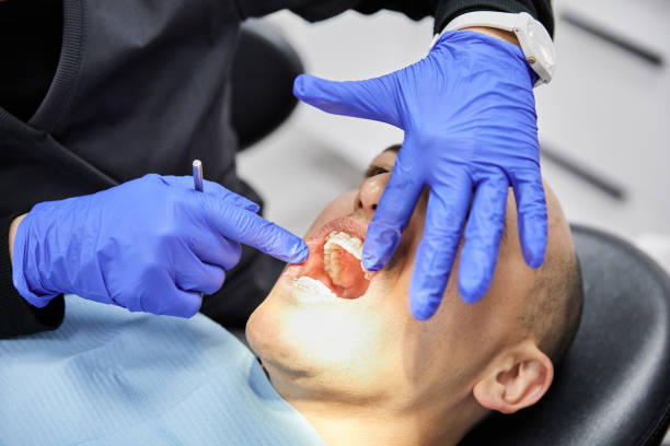 Teeth Whitening in OR